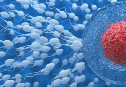Therapeutic Donor Insemination Doctor in Malad West