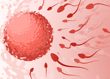 theraputic insemination by donor